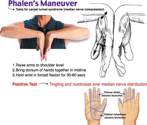 median nerve compression test carpal tunnel|positive tinel's and phalen's.